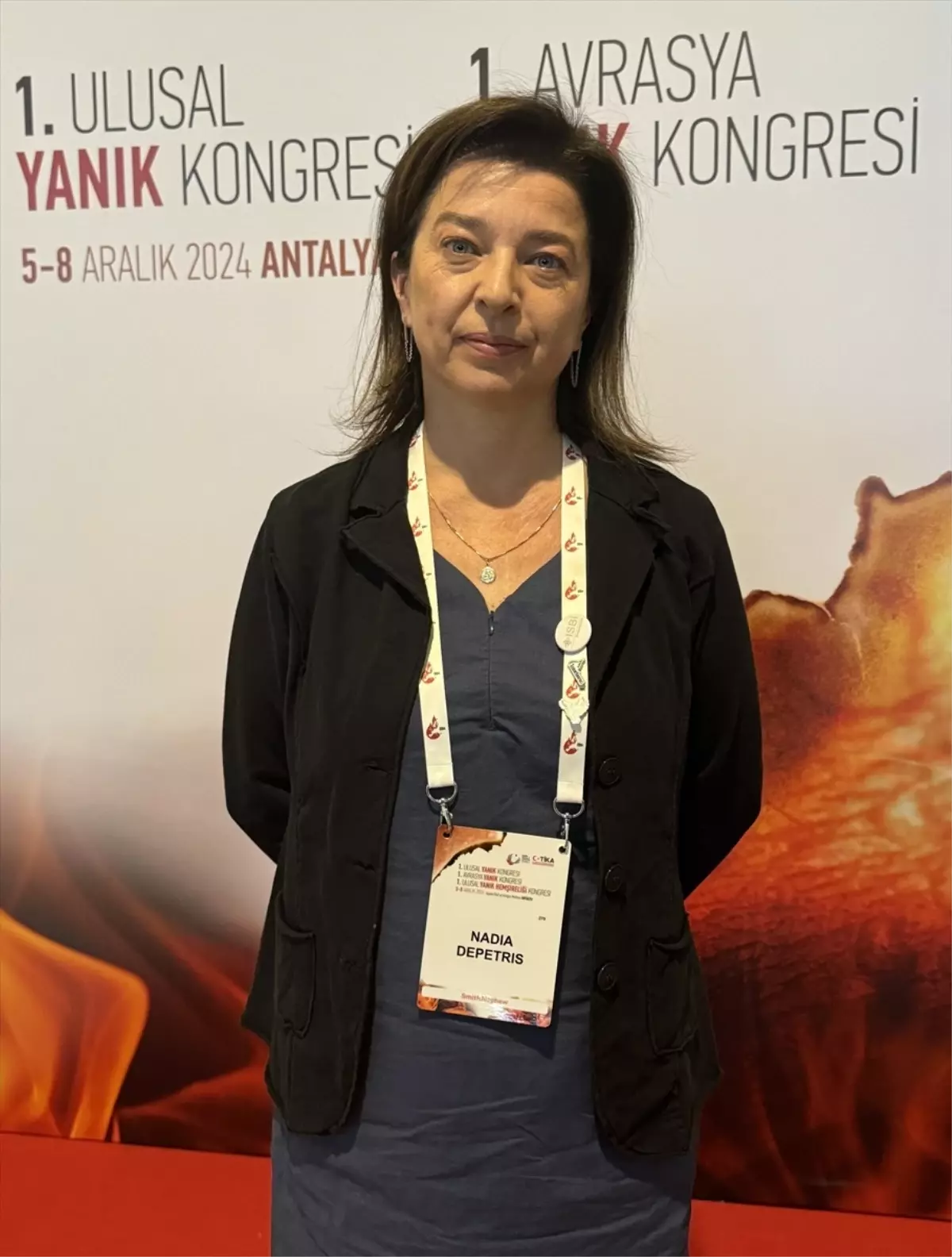 Türkiye Yanık Tedavisinde Referans Ülke